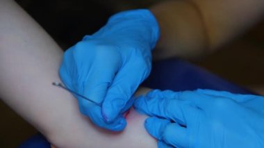 Dövmeyi yakın plan yaptırma süreci. El dürtme dövmesi yakın plan. Dövmeyi iğneyle doldurmak..