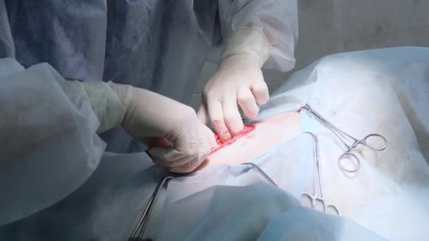 Een Dierenarts Voert Een Operatie Uit Het Lichaam Van Hond — Stockvideo