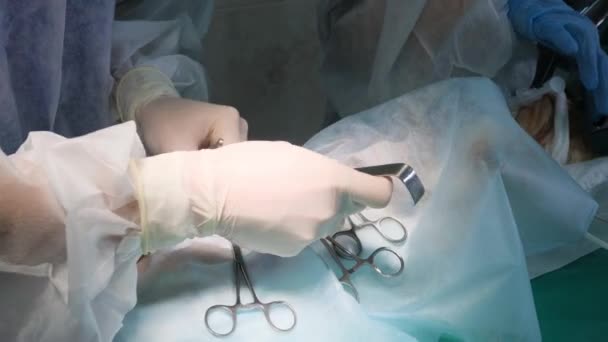 외과의사의 수술실에서 복잡한 수술을 수행합니다 클로즈업 — 비디오