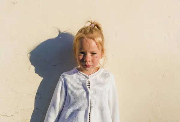 Porträt Eines Kleinen Mädchens Mit Einer Platzwunde Gesicht Nach Einem — Stockfoto