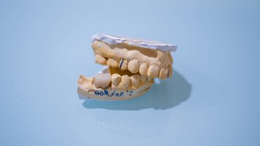 Arkaplanda parlak turuncu ve yeşil sandalyeler olan yansıtıcı bir yüzeyde detaylı bir diş kalıbı. Modern bir diş sağlığı kliniğinde diş anatomisi ve ortodontik çalışmaları gösteriyor.