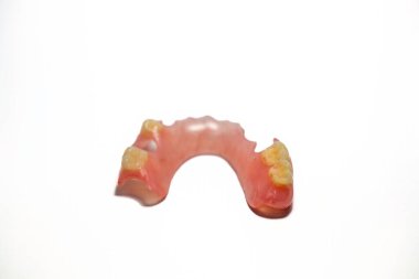 Kısmi takma diş esnek malzemelerden yapılmış. Beyaz bir arkaplanda fotoğraflanmış.