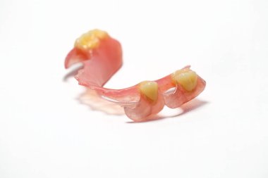 Kısmi takma diş esnek malzemelerden yapılmış. Beyaz bir arkaplanda fotoğraflanmış.