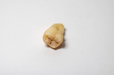 Yeni çıkarılmış bir azı dişinin enine kesiti. Sulkusta siyah renkle gösterilen karaciğer hücreleri var. Beyaz bir arkaplanda fotoğraflandı.