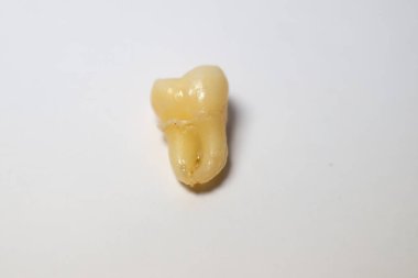 Yeni çıkarılmış bir azı dişi. Beyaz bir arkaplanda fotoğraflandı.