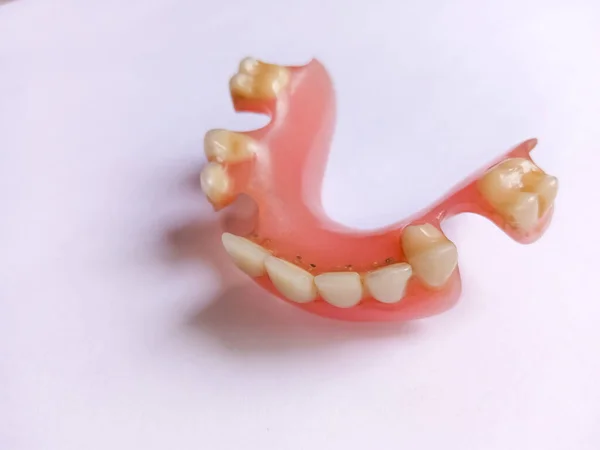 False Teeth Fake Teeth Dentures White Background Close Dentures Removable — Stock Photo, Image
