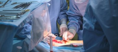 Cerrahi odasında açık ameliyat yapan bir hastayı ameliyat eden doktorların elleri. Sağlık ve tıbbi müdahale kavramı.