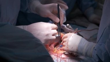 Cerrahi odasındaki açık kalp ameliyatı sırasında bir hastayı ameliyat eden profesyonel doktorların yakınlaşması. Sağlık ve tıbbi müdahale kavramı.