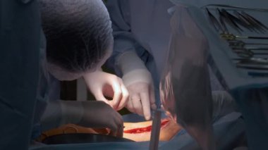 Cerrahi doktorlardan oluşan bir ekip bir hastayı ameliyat odasında ameliyat ediyor. Sağlık ve tıbbi yardım kavramı.