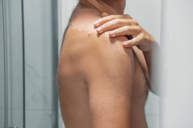 Güneş soyulan bir adam omuzunda ve sırtında eli olan derisi soyulmuş. Güneş yanığı derisi. Derisi soyuluyor, yanmış deri. Kapatın. Cilt bakımı kavramı.