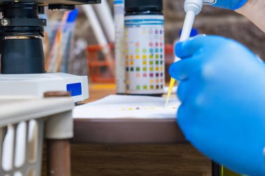 Doktor, pipetten idrar damlatarak test şeridi testine ya da idrar enfeksiyonuna karşı labirente giriyor. Protein, lökosit, Uroikojen, Bilirubin, Kan, Nitrit, pH analizi için tıbbi laboratuvarda idrar testi.