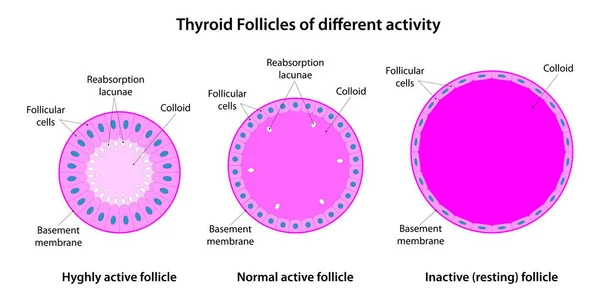 Folículos Tiroideos Actividad Diferente —  Fotos de Stock