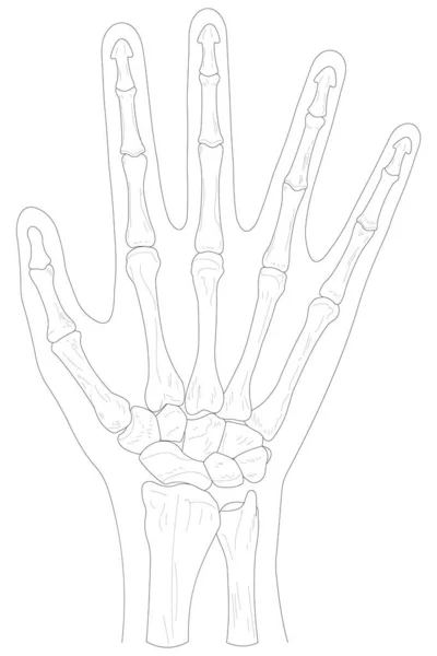 Bones Right Hand Dorsal Posterior View Black White Illustration — Archivo Imágenes Vectoriales