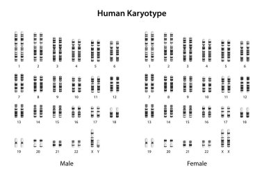 İnsan Karyotipi (erkek ve kadın))