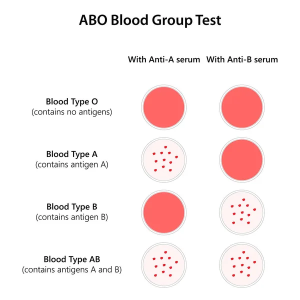Teste Grupo Sanguíneo Abo Ilustração — Fotografia de Stock