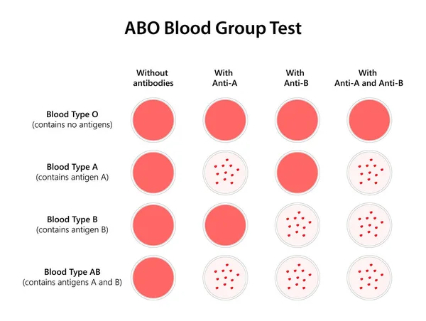 Teste Grupo Sanguíneo Abo Ilustração — Fotografia de Stock