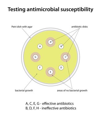 Antimikrobiyal duyarlılığı test ediliyor (disk dağılım testi)