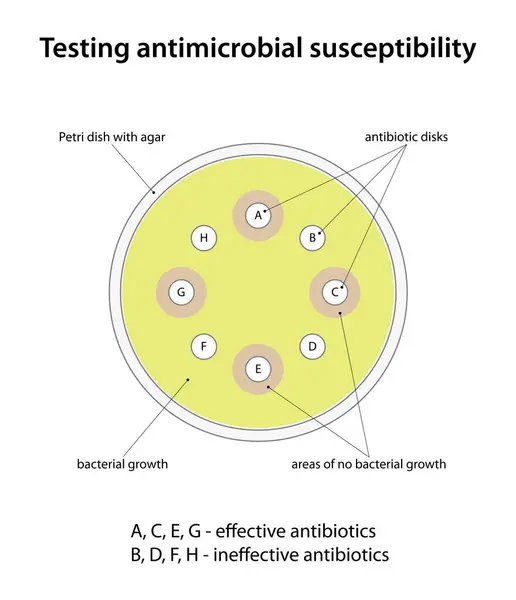 Stock vector Testing antimicrobial susceptibility (disk diffusion test)