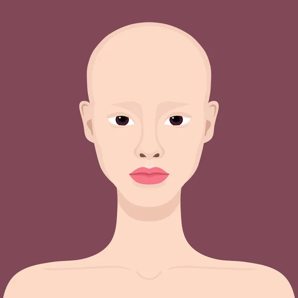 Jovem Com Alopecia Linda Careca Alopecia Areata Ilustração Vetorial — Vetor de Stock