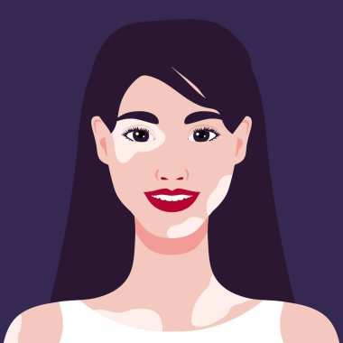 Vitiligo depigmentasyonu olan güzel, gülümseyen genç bir kadın. Nadir bir görüntü. Portre ya da avatar. Vektör illüstrasyonu