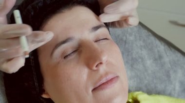 Yakın plan. Doktor, koruyucu eldivenlerle, hastaların alnına güzellik iğneleri için işaretler yapıyor. Orta yaşlı bir kadın sağlık kliniğinde güzellik yüz kozmetolojisi prosedürüne tabi tutuluyor.