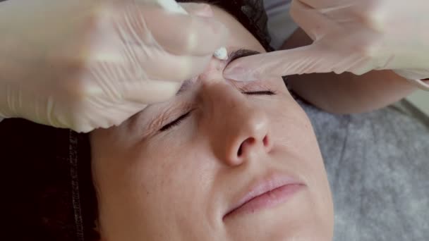 戴着防护手套 在病人的额头上做美容注射标记 中年妇女在保健诊所接受美容面部美容术治疗 — 图库视频影像