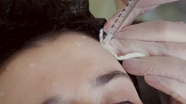 close-up. Doctor, in protective gloves, puts beauty injection to client forehead with syringe. Middle-aged woman gets beauty facial cosmetology procedure in healthcare clinic.