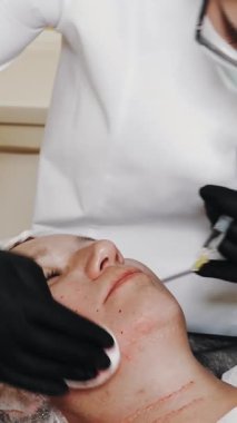 Güzellik iğnesi. Yaşlanma önleyici iğneler. Yüz tazeleme. Doktor güzellik iğneleri yapıyor. Mezoterapi ve biyo-evitalleşme. Kolajen enjeksiyonları. Güzellik konsepti.