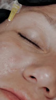 Güzellik iğnesi. Yaşlanma önleyici iğneler. Yüz tazeleme. Doktor güzellik iğneleri yapıyor. Yakın plan. Mezoterapi ve biyo-evitalleşme. Kolajen enjeksiyonları. Güzellik konsepti.