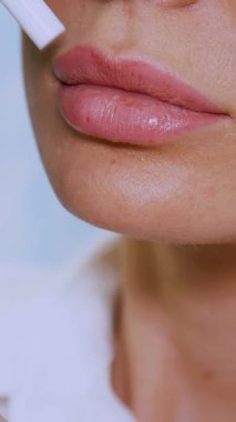 Büyük bir dudak planı, doktor hastaya hiyalüronik asit enjekte etmek için dudak bölgesini gösterir, dudak büyütme prosedürünü tartışır. Klinik, güzellik salonu..