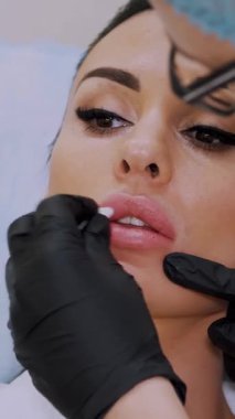 Siyah steril eldivenli doktor hastanın dudaklarına hyaluronik asit enjekte ediyor. Dudakların hacmini arttırmak için prosedür, dudakların şeklini düzeltmek için. Sağlık Ofisi.