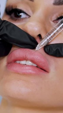 Siyah steril eldivenli doktor hastanın dudaklarına hyaluronik asit enjekte ediyor. Dudakların hacmini arttırmak için prosedür, dudakların şeklini düzeltmek için. Sağlık Ofisi.