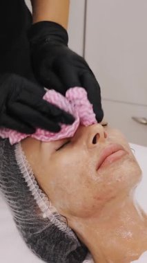 Siyah tıbbi eldivenlerle yakın plan kozmetik uzmanı, özel ıslak mendilli kadın yüzünden kozmetik yüz ürününün kalıntılarını çıkarıyor. Kozmetik kliniğinde veya güzellik salonunda cilt bakımı prosedürü.