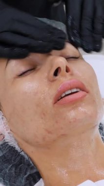 Siyah tıbbi eldivenlerle kozmetik uzmanı, kozmetik kliniğinde ya da güzellik salonunda özel kozmetik jel kullanan bir kadına cilt bakımı, yüz masajı yapıyor..