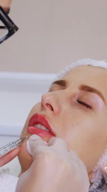 Yakın plan, kadın yüzü. Cerrah, tıbbi eldivenlerle kadının dudağına şırınga batırır ve yavaşça hyaluronik asit enjekte eder. Dudak büyütme prosedürü. Güzellik iğneleri. Estetik ameliyat.
