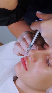 Dudak büyütme prosedürü. Yakın plan, kadın yüzü. Cerrah, tıbbi eldivenlerle kadının dudağına şırınga batırır ve yavaşça hyaluronik asit enjekte eder. Güzellik iğneleri. Estetik ameliyat.