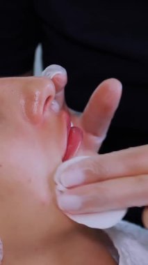 Yakın plan. Dudak büyütme prosedürü. Cerrah, tıbbi eldivenlerle, dişinin dudaklarına masaj yaparak güzellik iğnelerinden sonra hyaluronik asit dağıtıyor. Estetik ameliyat.
