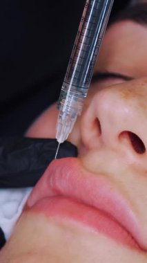 Yakın plan, kadın yüzü. Cerrah, tıbbi eldivenlerle üst kadın dudağına şırınga batırır ve yavaşça hyaluronik asit enjekte eder. Dudak büyütme prosedürü. Estetik ameliyat.