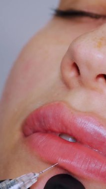 Yakın plan, kadın yüzü. Cerrah, tıbbi eldivenlerle kadının dudaklarına dikkatlice ve yavaşça hyaluronik asit enjekte ediyor. Dudak büyütme prosedürü. Güzellik iğneleri. Estetik ameliyat.