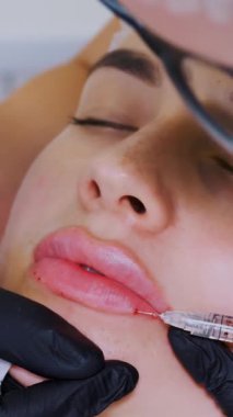 Yakın plan, kadın yüzü. Cerrah, tıbbi eldivenlerle kadının dudağına şırınga batırır ve yavaşça hyaluronik asit enjekte eder. Dudak büyütme prosedürü. Güzellik iğneleri. Estetik ameliyat.