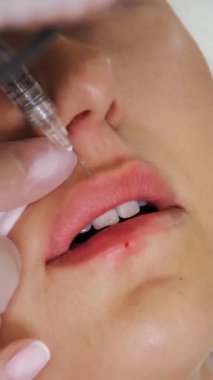 Close-up, female lips. Surgeon, in medical gloves, carefully and slowly injects hyaluronic acid into woman's lips with a syringe. lip augmentation procedure. beauty injections. Plastic surgery.