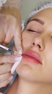 Yakın plan, kadın yüzü. Cerrah, tıbbi eldivenlerle kadının dudaklarına dikkatlice ve yavaşça hyaluronik asit enjekte ediyor. Dudak büyütme prosedürü. Güzellik iğneleri. Estetik ameliyat.