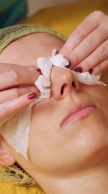 Kozmetoloji, yüz temizleme. Kadınlar için kozmetik prosedürler. Yakın plan. Kadın kanepede uzanıyor ve güzellik kliniğinde yüz temizleme ameliyatı oluyor. Cilt bakımı, cilt bakımı.