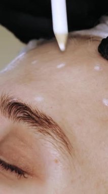 Güzellik iğnesi. Yaşlanma önleyici iğneler. Botulinum terapisi. Yüz tazeleme. Doktor, hastanın alnına güzellik iğneleri için işaretler yapıyor. Kolajen enjeksiyonları. Güzellik konsepti.