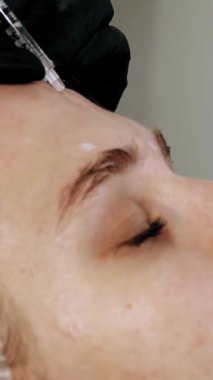 Güzellik iğnesi. Yaşlanma önleyici iğneler. Botulinum terapisi. Yüz tazeleme. Doktor güzellik iğneleri yapıyor. Kolajen enjeksiyonları. Güzellik konsepti.