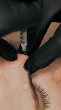 Güzellik iğnesi. Yaşlanma önleyici iğneler. Botulinum terapisi. Yüz tazeleme. Doktor güzellik iğneleri yapıyor. Kolajen enjeksiyonları. Güzellik konsepti.