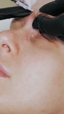 Güzellik iğnesi. Yaşlanma önleyici iğneler. Botulinum terapisi. Yüz tazeleme. Doktor güzellik iğneleri yapıyor. Kolajen enjeksiyonları. Güzellik konsepti.