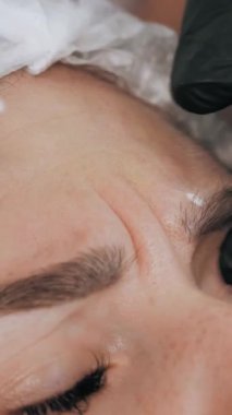 Güzellik iğnesi. Yaşlanma önleyici iğneler. Botulinum terapisi. Yüz tazeleme. Doktor, hastanın alnına güzellik iğneleri için işaretler yapıyor. Kolajen enjeksiyonları. Güzellik konsepti.