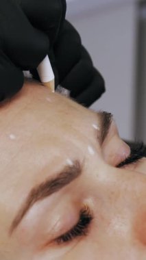 Güzellik iğnesi. Yaşlanma önleyici iğneler. Botulinum terapisi. Yüz tazeleme. Doktor, hastanın alnına güzellik iğneleri için işaretler yapıyor. Kolajen enjeksiyonları. Güzellik konsepti.