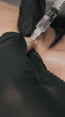 Güzellik iğnesi. Yaşlanma önleyici iğneler. Botulinum terapisi. Yüz tazeleme. Doktor güzellik iğneleri yapıyor. Kolajen enjeksiyonları. Güzellik konsepti.